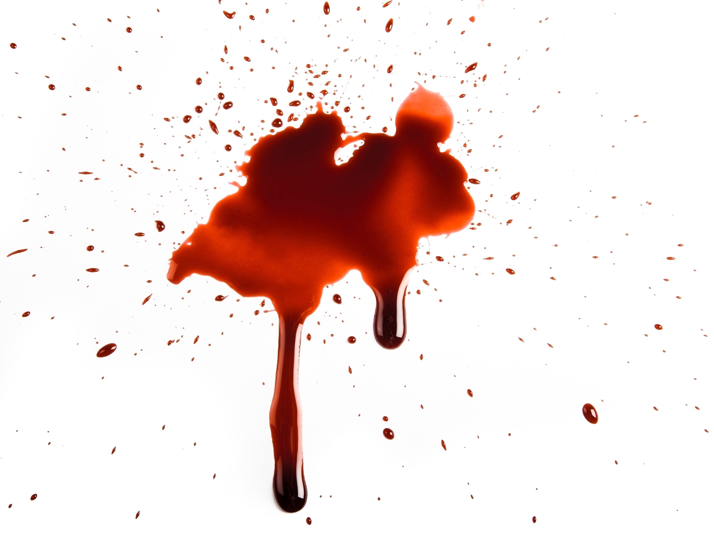  Sanjati krv u ustima: što to znači? Je li to dobro ili loše?
