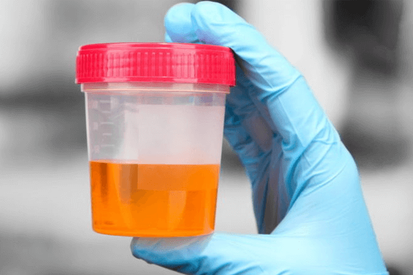  Sanjati urin: koja su značenja?
