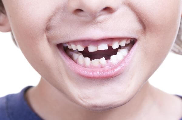  Śnić o krzywych zębach - co to znaczy? Odpowiedzi tutaj!